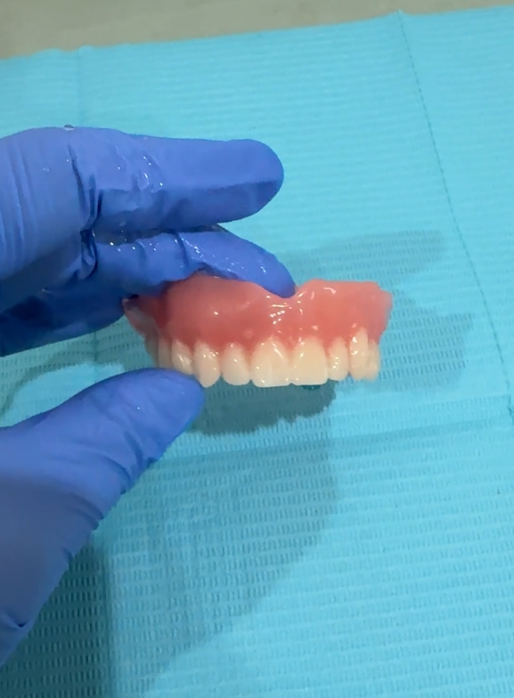 A finished denture held in a gloved hand