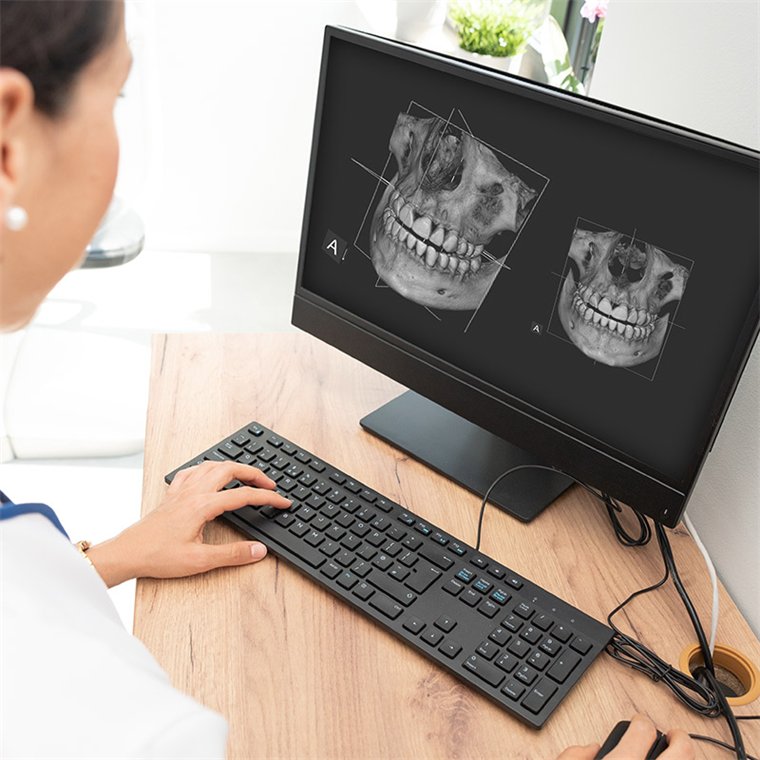 A scanner beside a screen showing a digital model of a dental arch